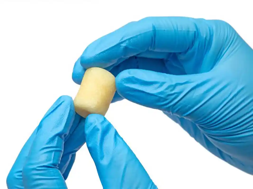 Bone Graft Putty