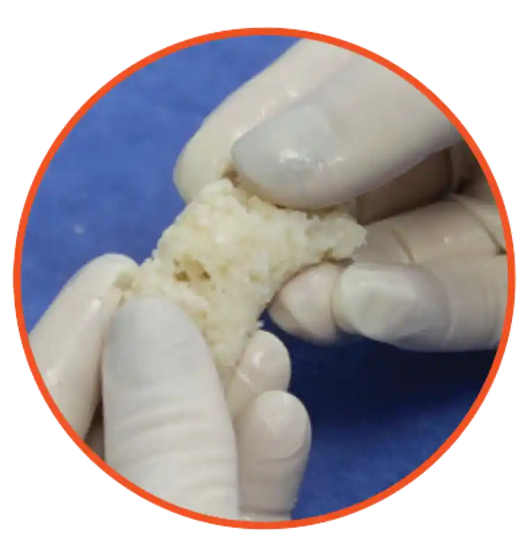Viable Bone Matrix